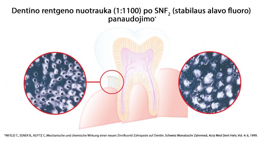Stabilus alavo fluoras