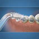 Waterpik ordtodontinis sepetelis
