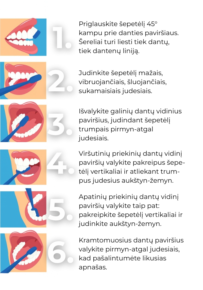 Modifikuota Bass dantų valymo technika